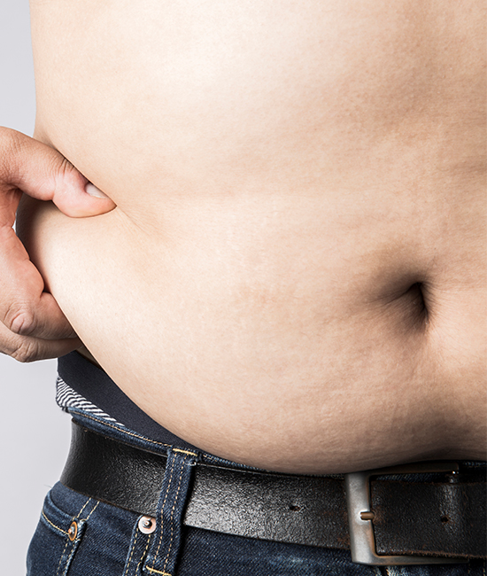 복부 · 내장비만형