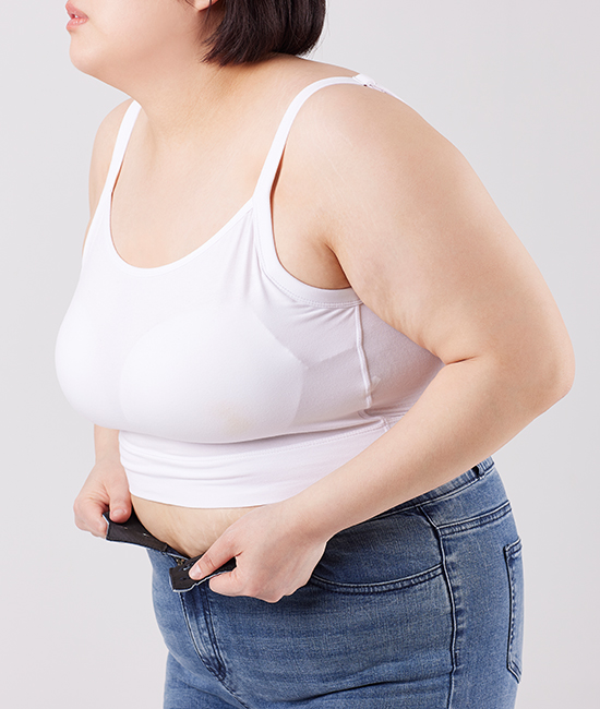 체형불균형형 비만